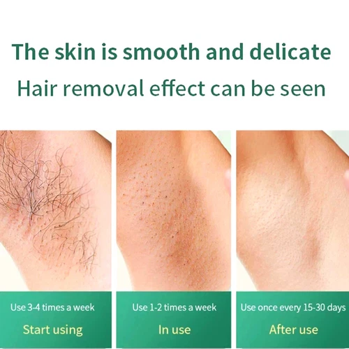 990000 Flashes Electric Depiladora Laser Permanent IPL Laser Hair Removal Device - Picture 9 of 24