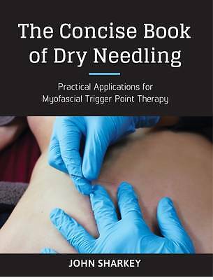 The Concise Book of Dry Needling: A Practitioner's Guide to Myofascial ...