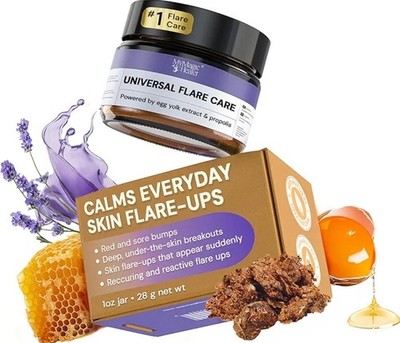 Universal Flare Care, Multi Putpose Solution, Iritated Skin Relief
