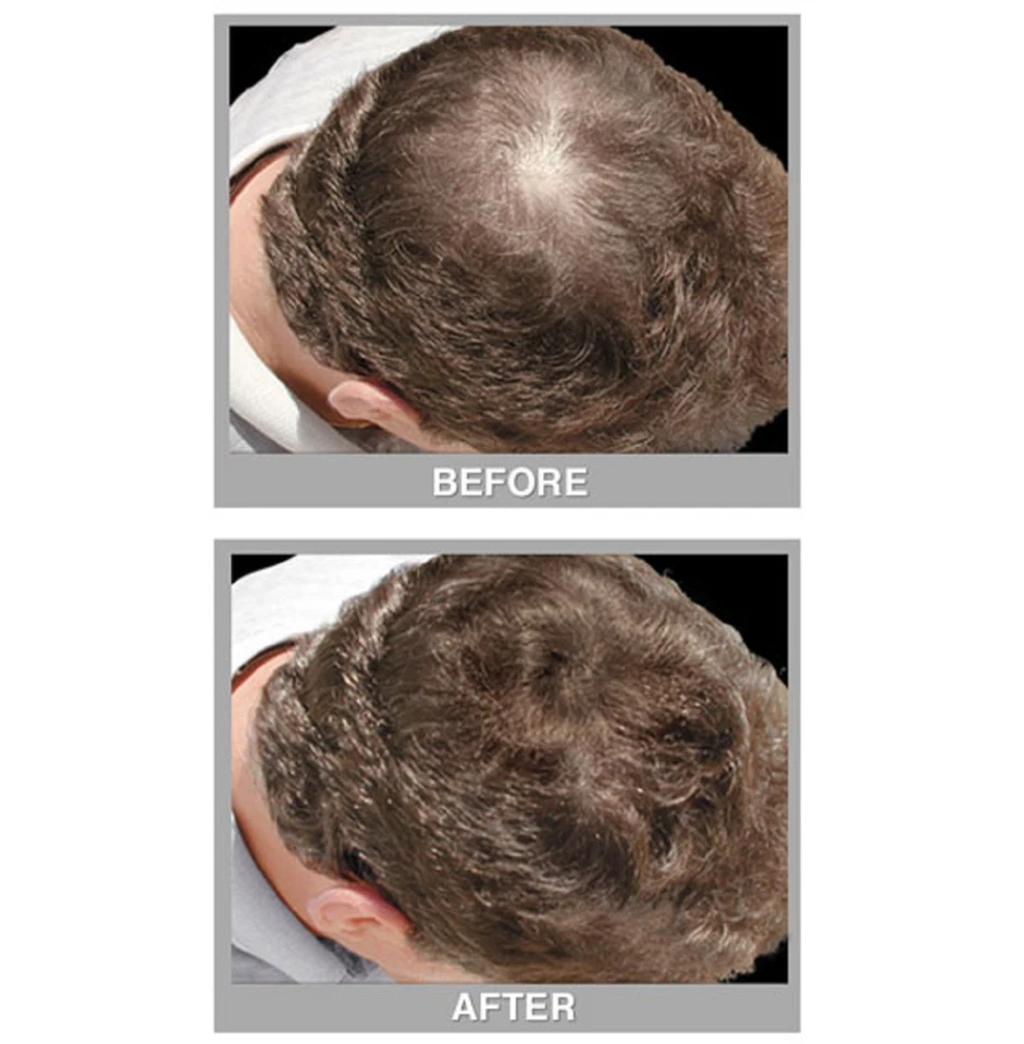 IRENE GARI CUBRE TU COLOR DE PELO POLVO RELLENO GRIS CON PROCAPIL PARA HOMBRE KIT. Foto 4 de 4