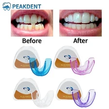 Myobrace Tooth Orthodontics Braces Veneers Anti Molar