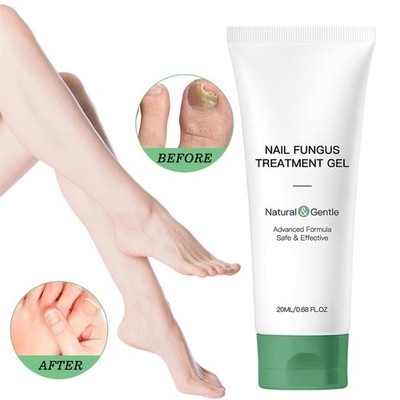 Nutraboost Nail Fungus Treatment Gel, Nail Fungus, Fungus Cream (1PCS)