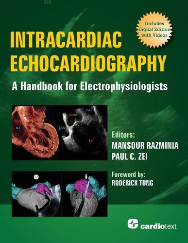 Thumbnail - Mansour Razmini Intracardiac Echocardiography: A Handb (taschenbuch)