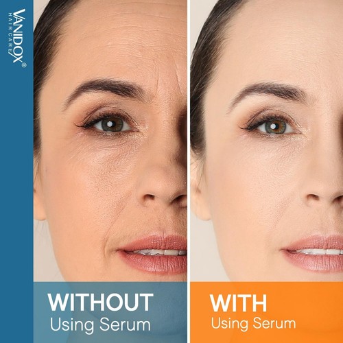 Super Vitamin C Serum for Women 70+, Firms, Lifts, Targets Wrinkles & Age Spot - Picture 6 of 7