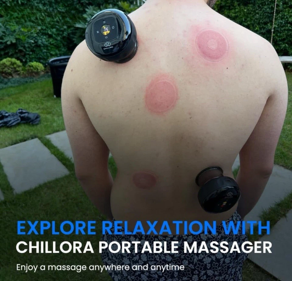 Juego de terapia de ventosas eléctricas 5 en 1 2 piezas, masajeador de terapia de ventosas, 15 niveles Foto 4 de 4