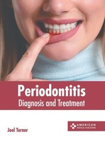Joel Turner | Periodontitis | Buch | Englisch (2023) | Diagnosis And Treatment