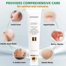 Medical-grade Scar Cream for Surgical Burns C-Section Scar Stretch Marks Keloids