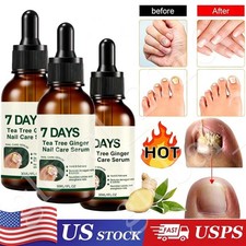 7 DAYS Nail Fungus Treatment Serum Care Hand and Foot Care Removal 30ml Pack1-3