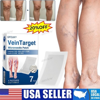  Varicose Vein Microneedle Patch Relieve Leg Swelling External Invisible Patch 