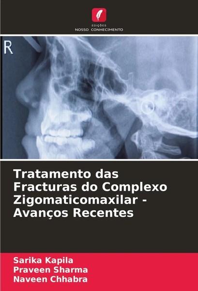 Sarika Kapila (U. A.) | Tratamento Das Fracturas Do Complexo...-image