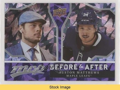 2021-22 Upper Deck MVP Before and After Auston Matthews #BA-1 READ 9jn