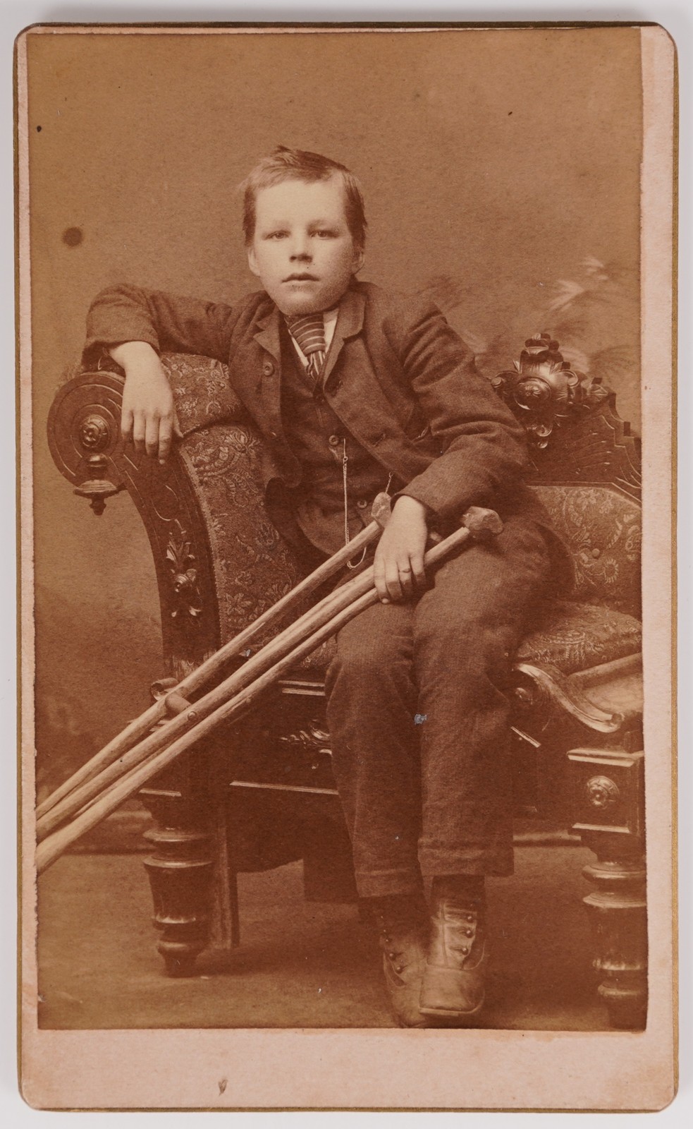 Antique CDV P. B. Smith Cute Young Boy With Crutches Injured Ithaca Michigan