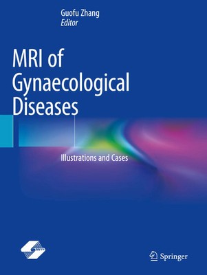 Guofu Zhang | MRI of Gynaecological Diseases | Taschenbuch | Englisch (2024)