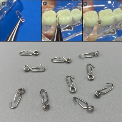 Dental Orthodontic Self-Locking Separating Springs Separate Metal Separator