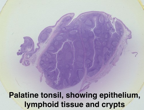 TURTOX Microscope Slide Set HUMAN Histology PATHOLOGY Embryology ORGAN SYSTEMS - Picture 5 of 9
