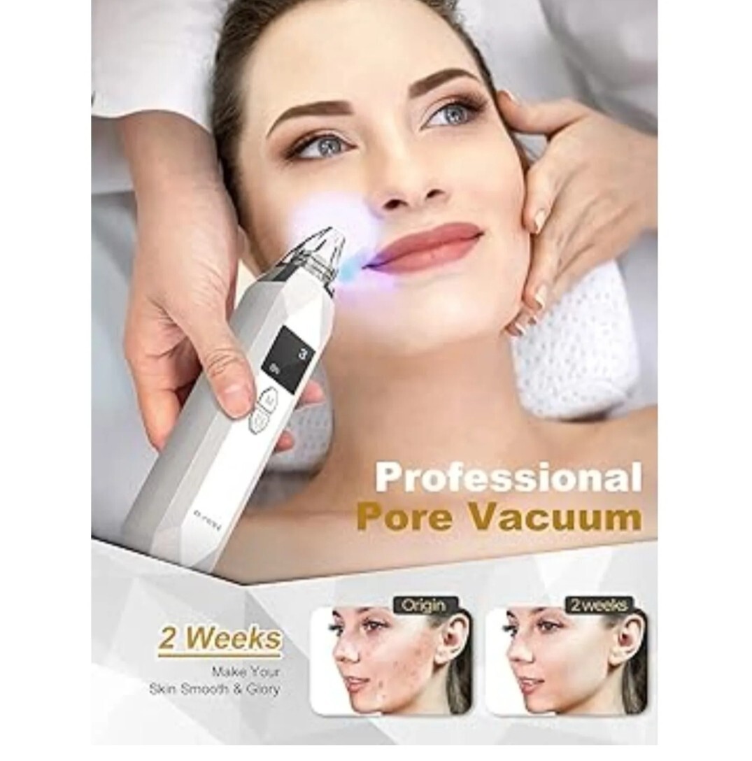 Blackhead Remover Electric Pore Nose Sucker Pimple Skin Acne Face Cleaner-Vacuum