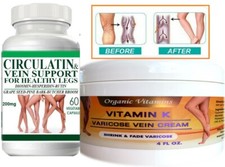 Varicose Veins Cream,Varicose Cream,Varicose Vein support Varicose Cream Herbal