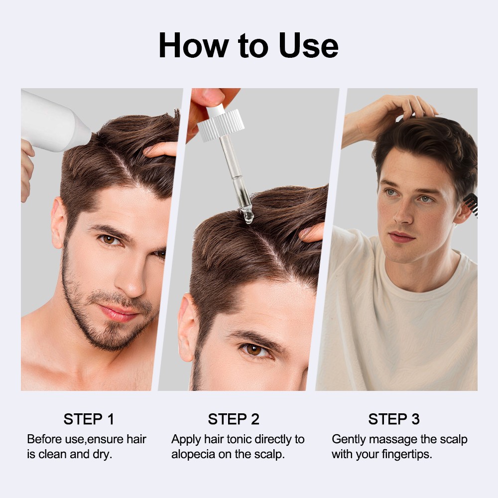 4Pcs Minoxidil 5% Hair Regrowth Treatment Hair Loss &Growth Scalp Liquid For Men