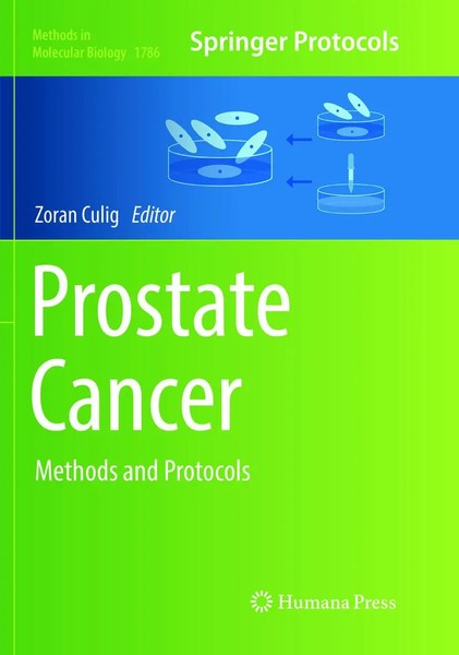 Zoran Culig | Prostate Cancer | Taschenbuch | Englisch (2019) | Xi | Humana-image