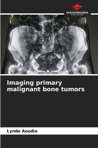 Imaging Primary Malignant Bone Tumors Lynda Aoudia-image