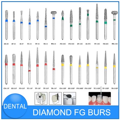 10Pcs/pack Dental Diamond FG High Speed Bur for Polishing Dentist Supplies 1.6mm