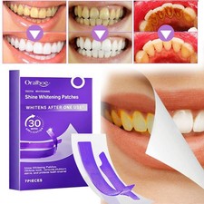 Purple Teeth Whitening Strips Brighten Tooth Remove Plaque Stain Cleaning Oral