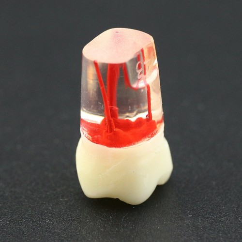 10PCS Kilgore Nissin Type Dental Root Canal Teeth Model For Endo Study Practice - Picture 74 of 80