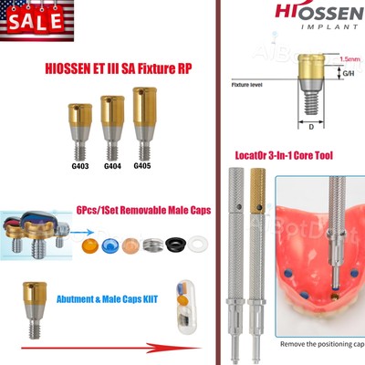 US Dental Locator Abutment Regular for HIOSSEN ET III SA/Osstem/DIO UF/Snucone R