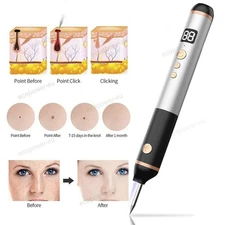 Anti-Aging Laser Plasma Pen Skin Remover Wart Tag Tattoo Mole Removal Dark Spot