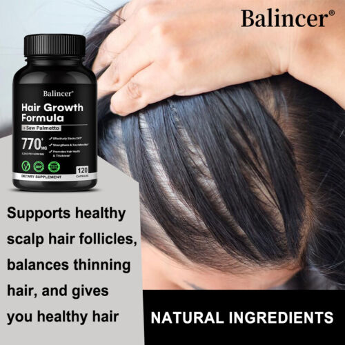 Saw Palmetto DHT Blocker Supplement | Haarwachstumsformel | Haarunterstützung - Bild 9 von 12