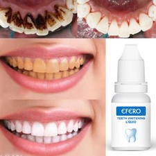 EFERO Teeth Cleaning Gel Whitening Essence Serum Oral Hygiene Dental Care Kit US