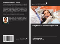 Chandni Batra (U. A.) | RegeneracióN óSea Guiada | Taschenbuch | Spanisch (2025)