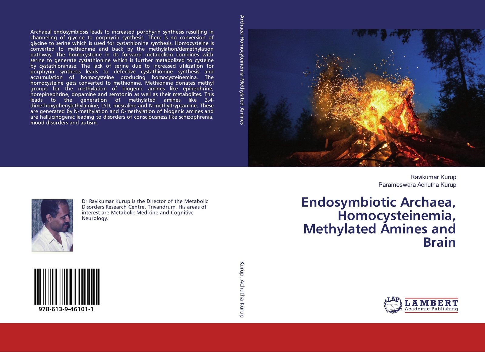 Thumbnail - Endosymbiotic Archaea, Homocysteinemia, Methylated Amines And Brain |