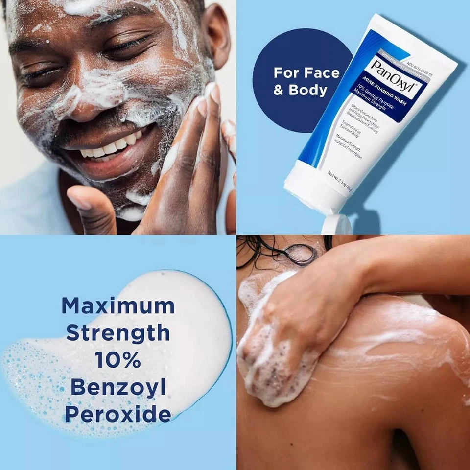 Moisture Benzoyl Peroxide 10% Foaming Acne Wash Skin Care 4% Daily Control Cream - image 3 of 4