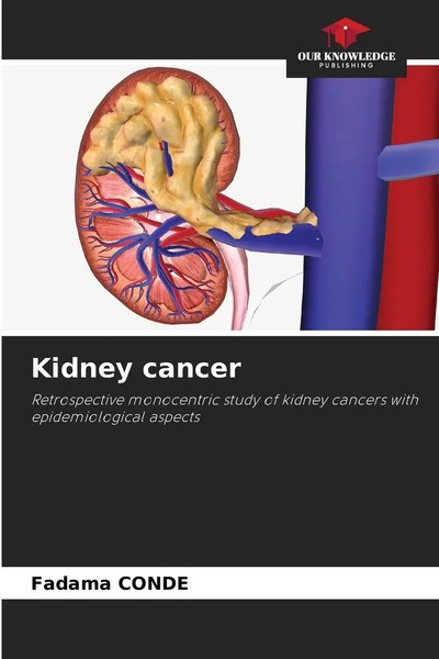 Fadama Conde | Kidney Cancer | Taschenbuch | Englisch (2025) | EAN 9786202003018-image