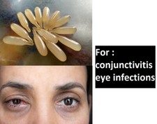 EYE popta used to treat bacterial eye infections (such as conjunctivitis).