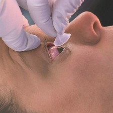 The Morgan Lens Occular Irrigation Device