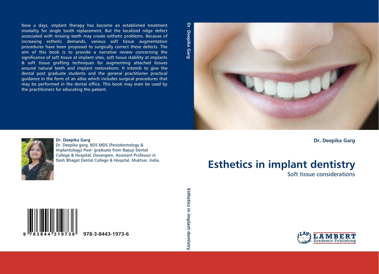 Thumbnail - Esthetics In Implant Dentistry | Soft Tissue Considerations | Deepika