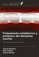 Tratamiento OrtodóNcico Y ProtéSico Del Diastema Maxilar Yosra Gassara (U. A.)