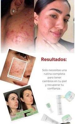 Tea Tree skincare specially formulated for oily and combination skin.