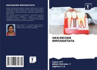 Sur'q A. R (U. A.) | Okkljuziya Implantata | Taschenbuch | Russisch (2024)