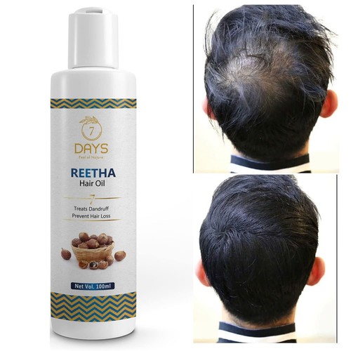 7 Tage Reetha Zwiebel Shikakai Bhringraj Amla Haaröl für Männer & Frauen, 100 % natürlich - Bild 1 von 9