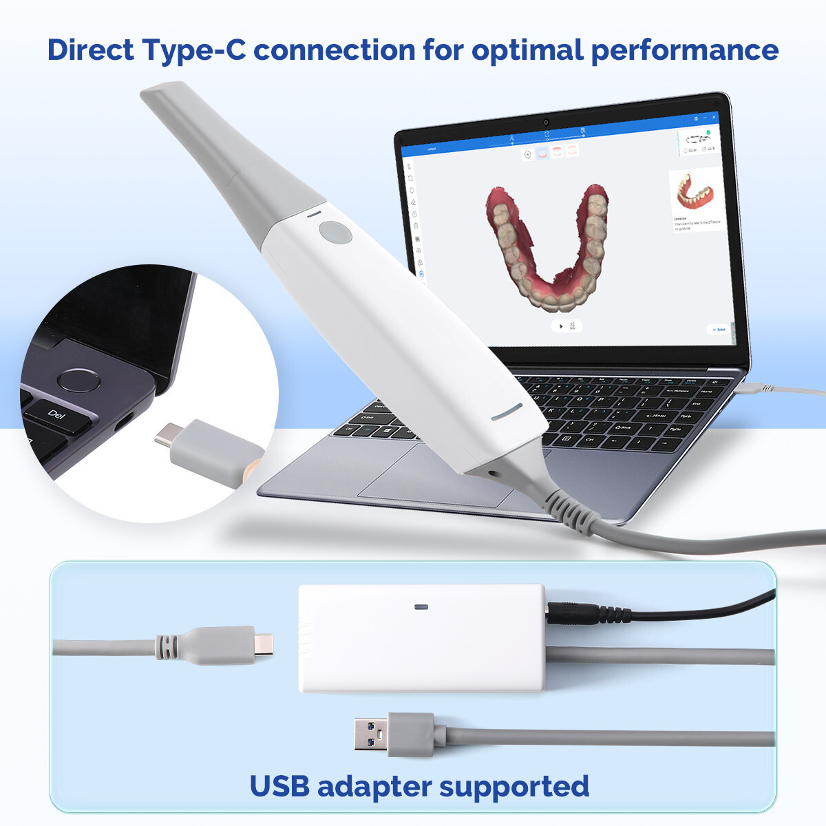 Dental USB Intraoral 3D Scanner CAD CAM High-Precision Imaging Scanner ...