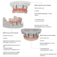 Modelo de implante dental de EE. UU. mandíbula superior/baja todo en 4 todo en 6 demostración de tratamiento