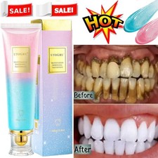 Niacinamide Intensive Whitening Toothpaste, Remove Tooth Stains, Fresh Breath