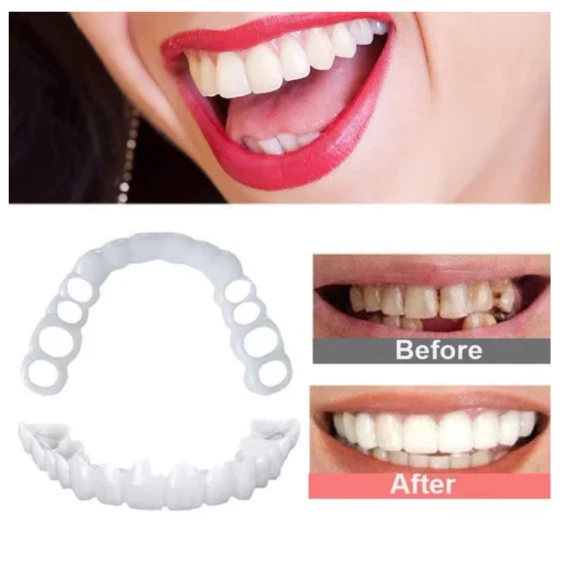 Snap On False Teeth Upper + Lower Dental Veneers Dentures Tooth Cover Set Hot UK - Image 3 of 4