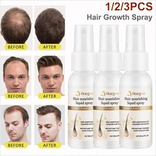 Hair Growth Serum Spray, Natural Hair Growth Spray W/ Mineral, Rosemary, Ginger