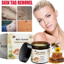 Bee Venom Skin Tag Removal Treatment Cream Body Care Mole Corn Wart Remover