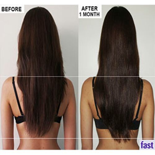 FAST Long Hair Growing Vitamin B Biotin Shampoo Conditioner + 53 Oil Treatment - Bild 10 von 20
