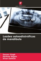 LesõEs OsteodistróFicas Da MandíBula Gaurav Singh (U. A.) Taschenbuch 2024